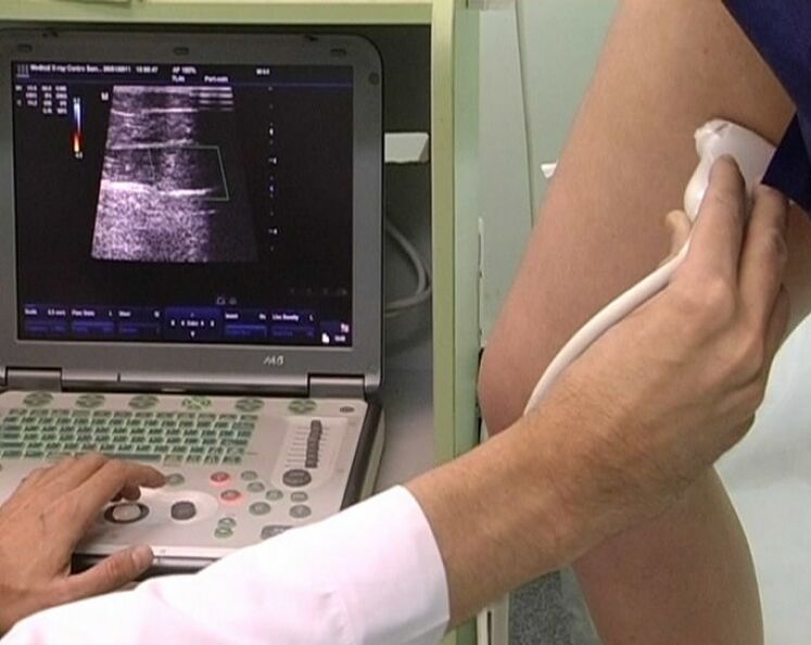 Ultraschalldiagnostik vun der Beckenkrampfadern